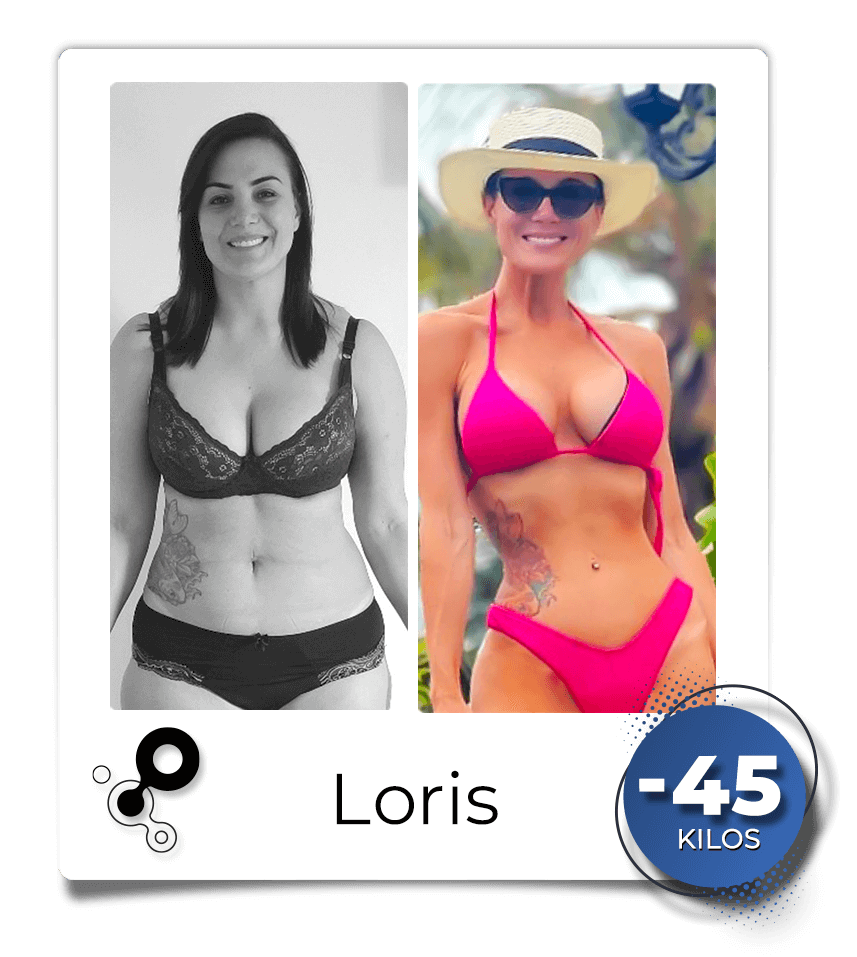 Antes-depois-Loris-1.png