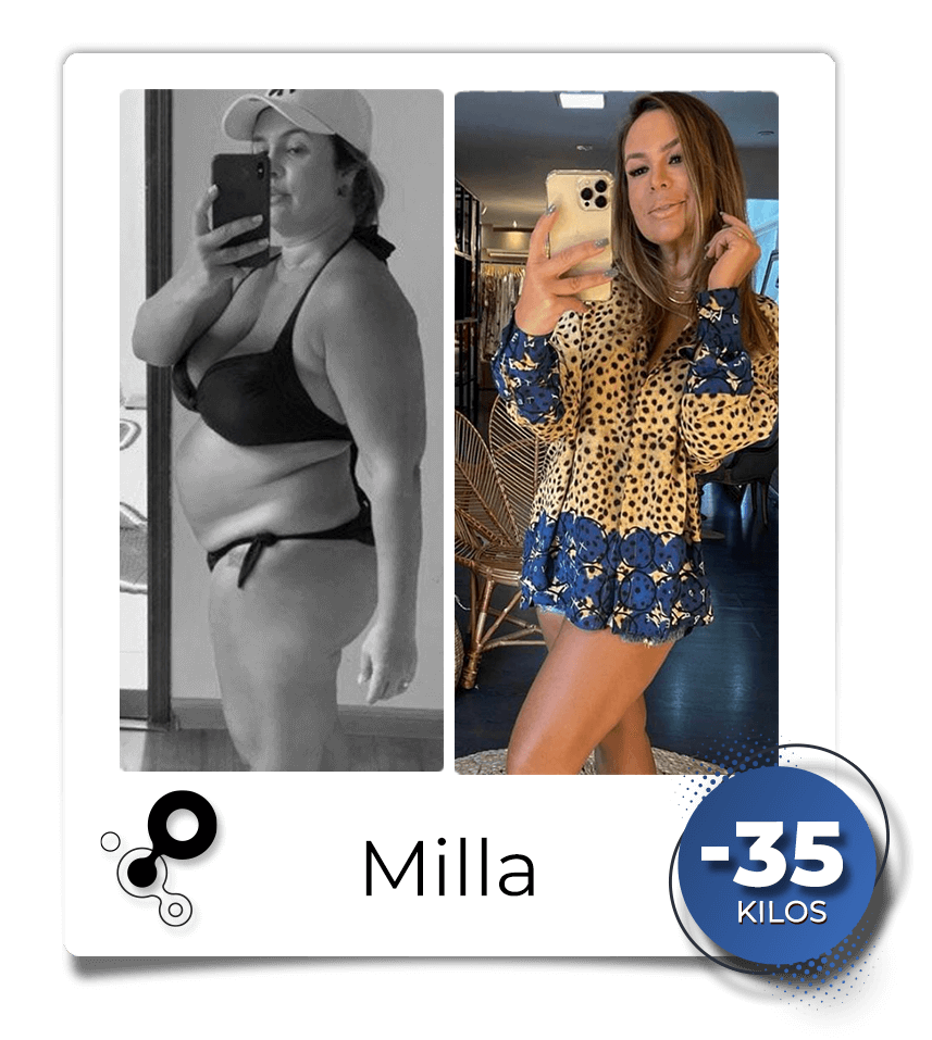 Antes-depois-Milla.png