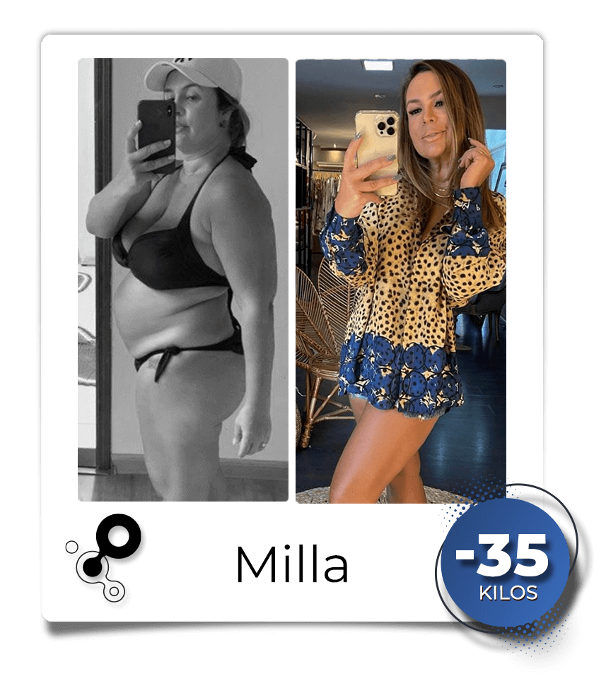 Antes-depois-Milla.png
